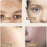 2PCS Acne Treatment Skin Care